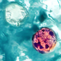 Democrats Overstate Role of Monitoring Program Change in Parasitic Outbreak