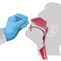 COVID-19 Nasal Swab Test Does Not Cause Risk of Infection